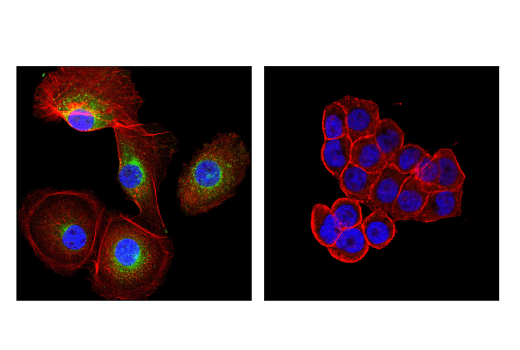 Immunofluorescence Image 1: GAS6 (D3A3G) Rabbit Monoclonal Antibody