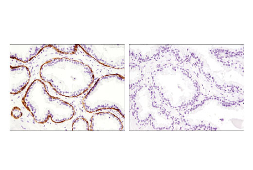 Immunohistochemistry Image 2: TRIM29/ATDC (E1L4E) Rabbit Monoclonal Antibody