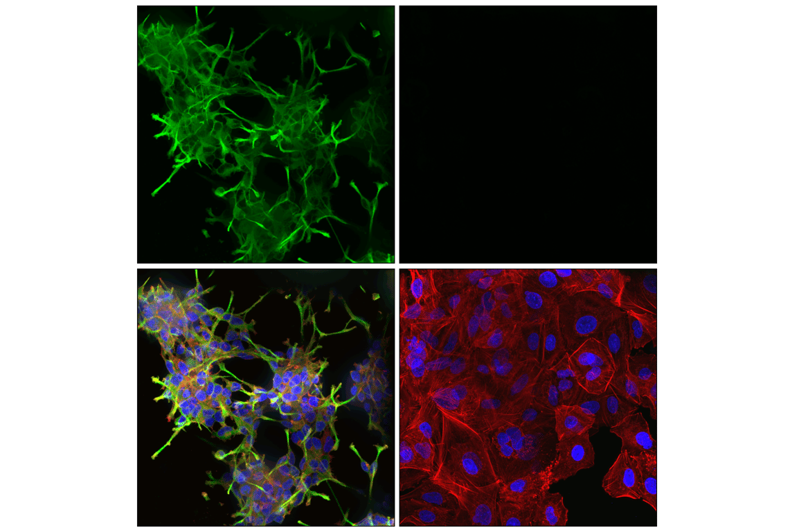Immunofluorescence Image 1: Doublecortin (F6K9E) Rabbit Monoclonal Antibody (BSA and Azide Free)