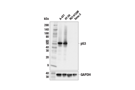 Western Blotting Image 1: p53 (E9B5W) Rabbit mAb