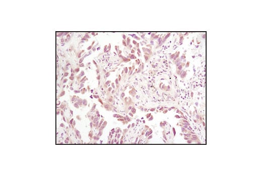 Immunohistochemistry Image 1: Thioredoxin 1 (C63C6) Rabbit Monoclonal Antibody