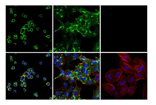 Immunofluorescence Image 1: TNFRSF8/CD30 (E7E4D) Rabbit Monoclonal Antibody