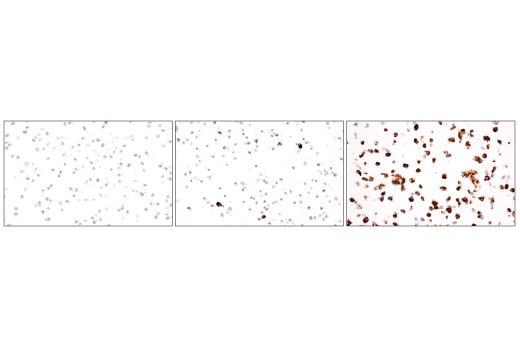 undefined Image 1: Lloviu Virus VP35 Antibody