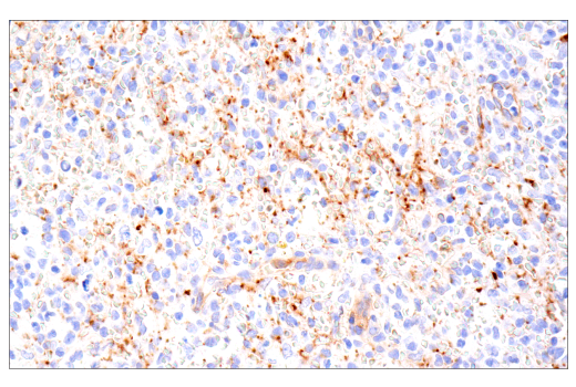 Immunohistochemistry Image 8: CD109 (E4I2V) Rabbit Monoclonal Antibody