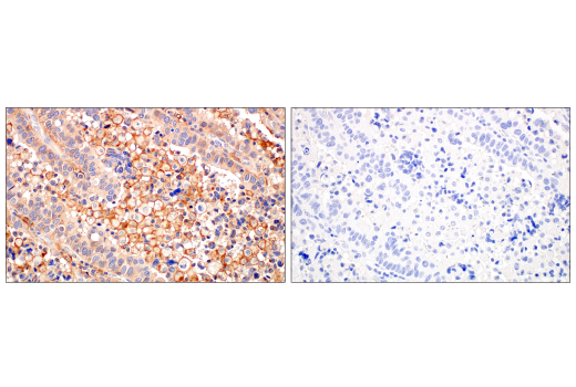 Immunohistochemistry Image 1: CMTM6 (E6A8T) Rabbit Monoclonal Antibody