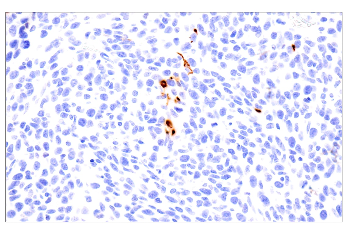 Immunohistochemistry Image 3: Cathepsin K (E7U5N) Rabbit Monoclonal Antibody (BSA and Azide Free)
