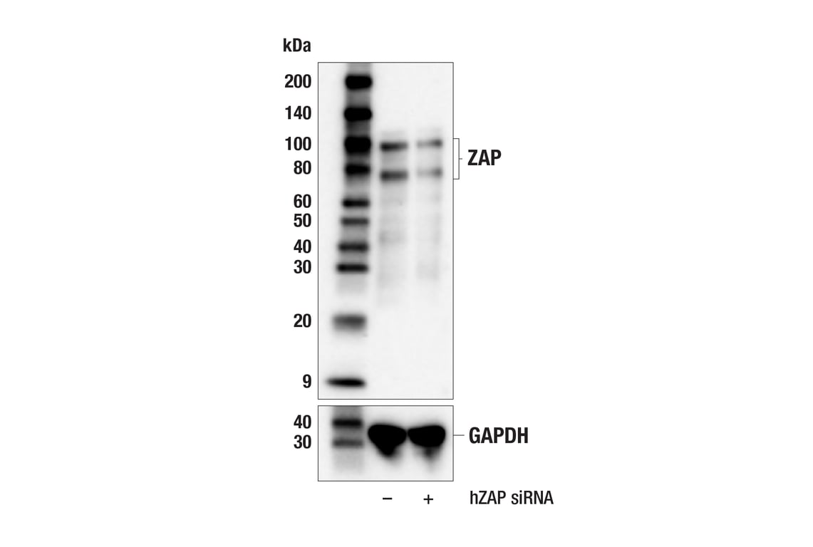 Western Blotting Image 3: ZAP (E5V4D) Rabbit Monoclonal Antibody
