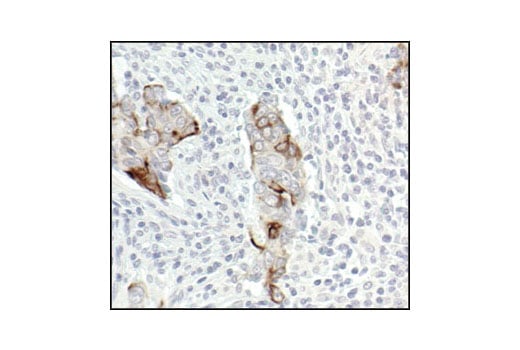 Immunohistochemistry Image 3: Phospho-IKK alpha/beta (Ser176/180) (16A6) Rabbit Monoclonal Antibody (BSA and Azide Free)