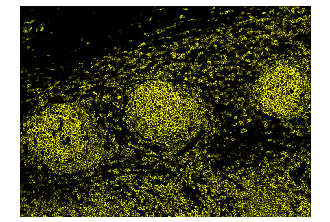 Immunohistochemistry Image 3: CD20 (E7B7T) & CO-0011-594 SignalStar<sup>™</sup> Oligo-Antibody Pair