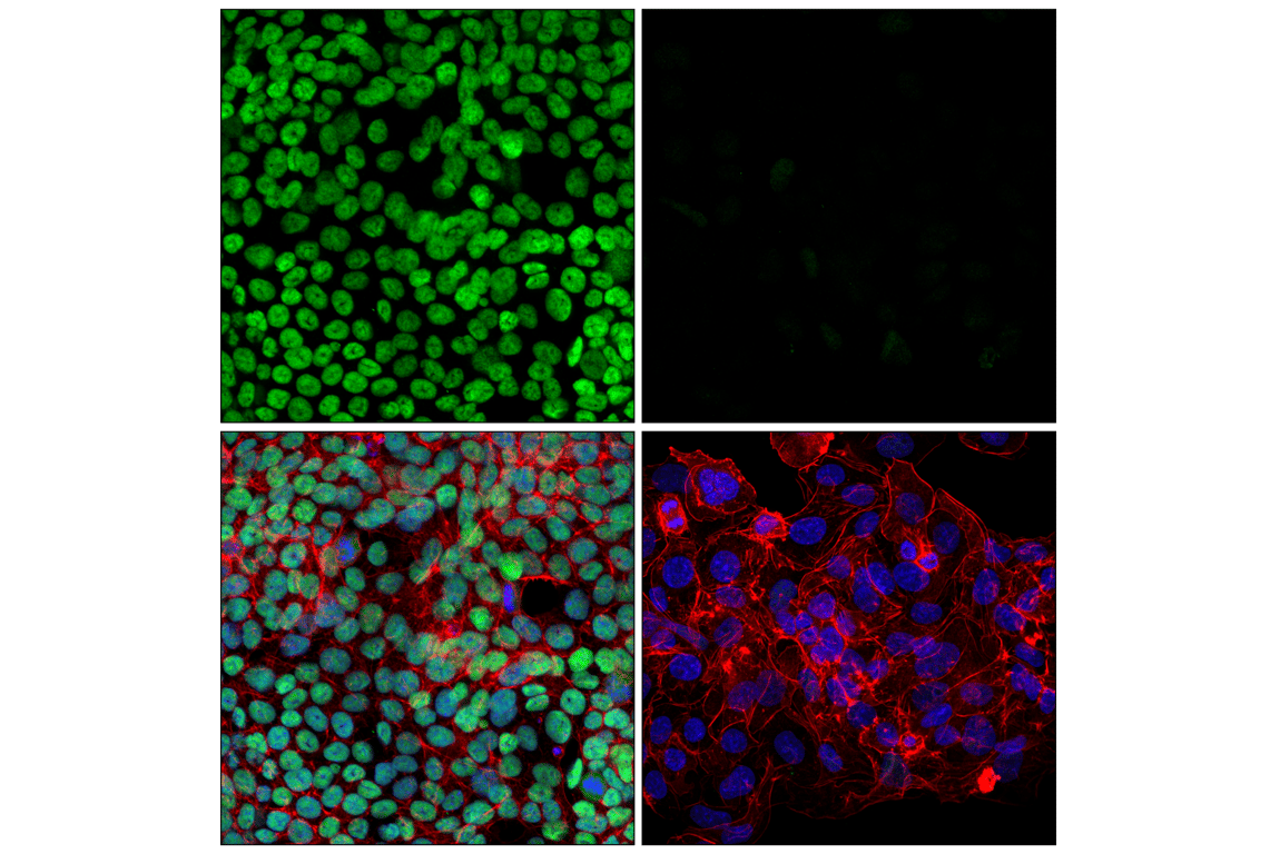 Immunofluorescence Image 1: XRCC4 (F6D7B) Rabbit Monoclonal Antibody