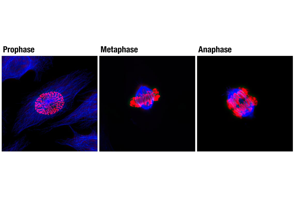 Immunofluorescence Image 1: Anti-rabbit IgG (H+L), F(ab')<sub>2</sub> Fragment (Alexa Fluor<sup>®</sup> 647 Conjugate)