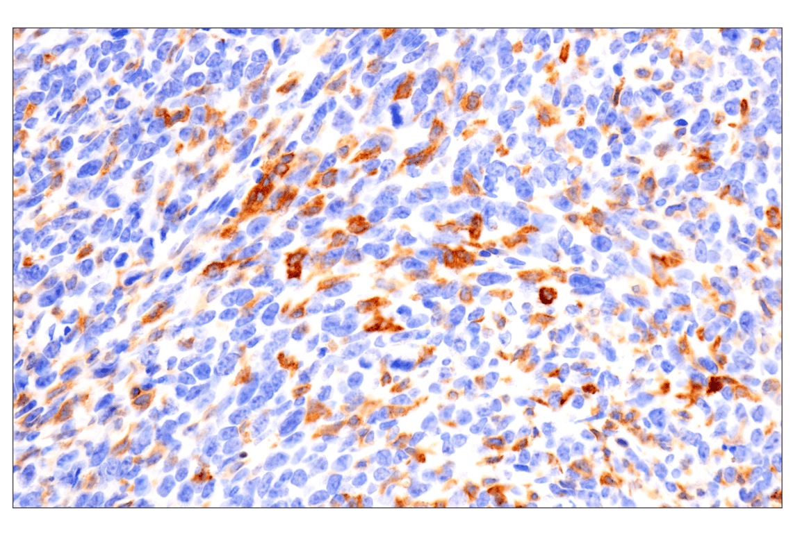 Immunohistochemistry Image 1: CD22 (F9D1W) Rabbit Monoclonal Antibody (BSA and Azide Free)