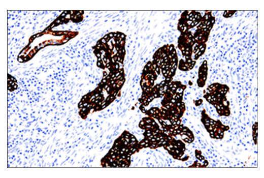 Immunohistochemistry Image 1: Keratin 5 (E2T4B) Rabbit Monoclonal Antibody