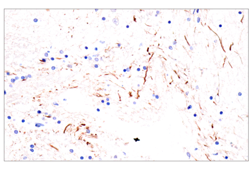 Immunohistochemistry Image 2: Neurofilament-H (E7Z7G) Rabbit Monoclonal Antibody