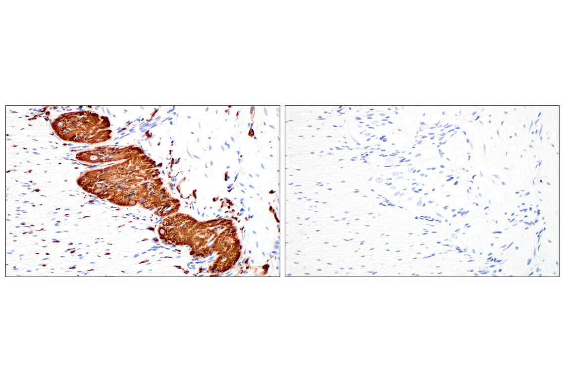 Immunohistochemistry Image 8: beta3-Tubulin (E9F3E) Mouse Monoclonal Antibody (BSA and Azide Free)