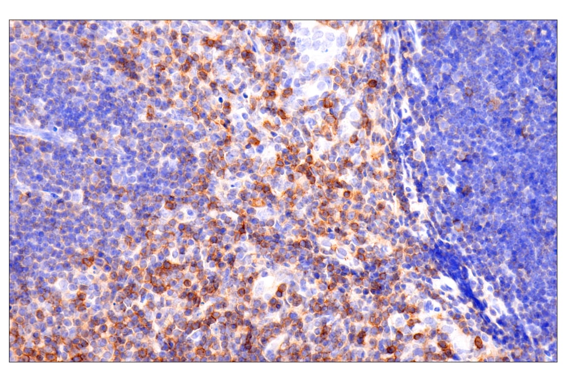 Immunohistochemistry Image 2: CD62L/L-Selectin (E7L2M) Rabbit Monoclonal Antibody (BSA and Azide Free)