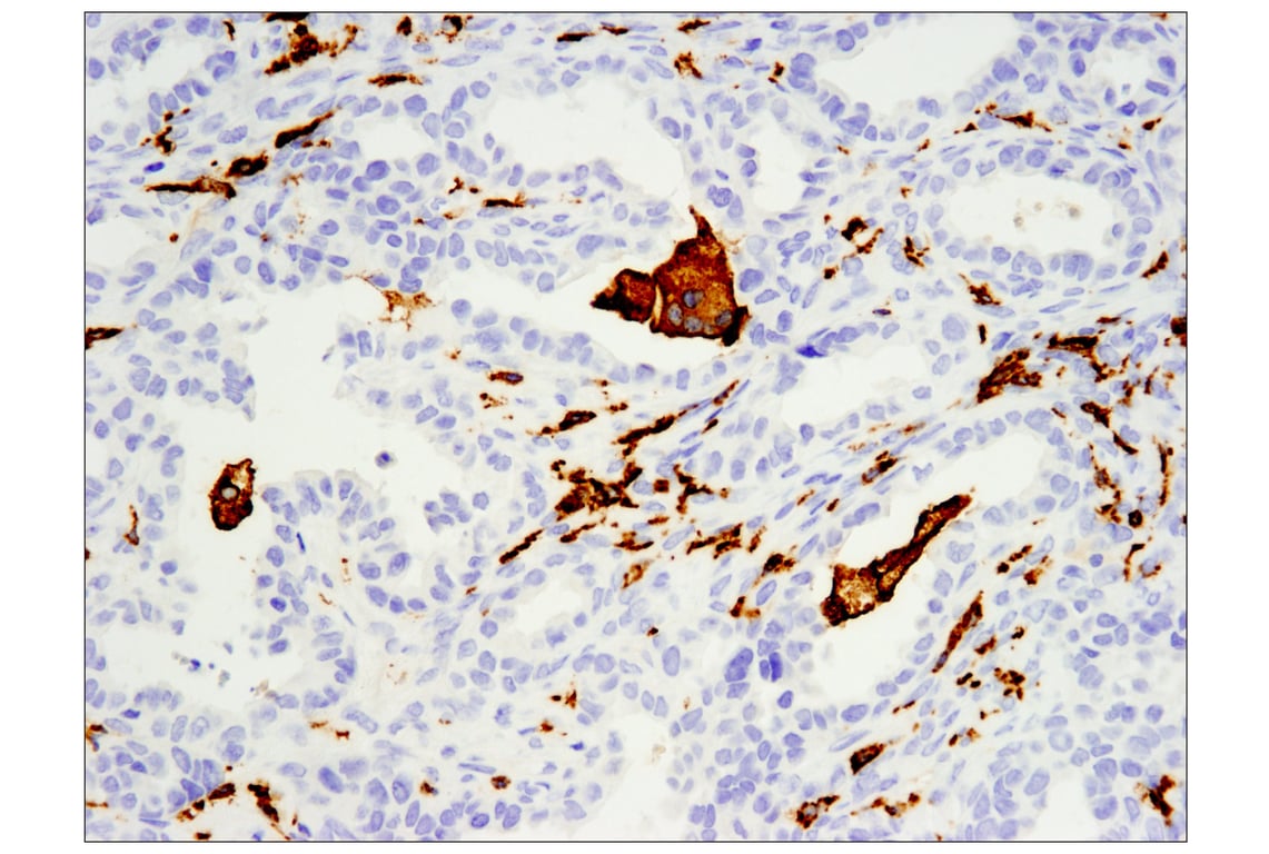 Immunohistochemistry Image 2: CD163 (D6U1J) Rabbit Monoclonal Antibody (BSA and Azide Free)