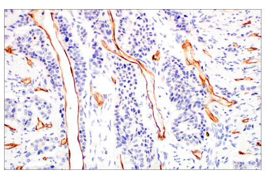 Immunohistochemistry Image 1: PLVAP (E3X9D) Rabbit Monoclonal Antibody
