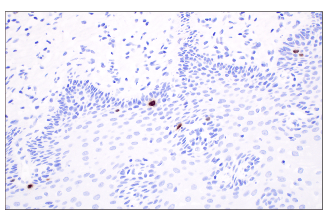 Immunohistochemistry Image 11: Phospho-Histone H3 (Ser10) (D7N8E) Rabbit Monoclonal Antibody