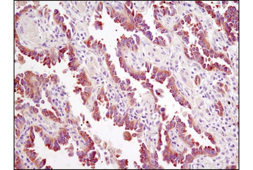 Immunohistochemistry Image 2: JIP4/SPAG9 (D72F4) Rabbit Monoclonal Antibody (BSA and Azide Free)