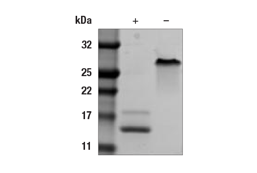 undefined Image 2: Human PDGF-BB Recombinant Protein