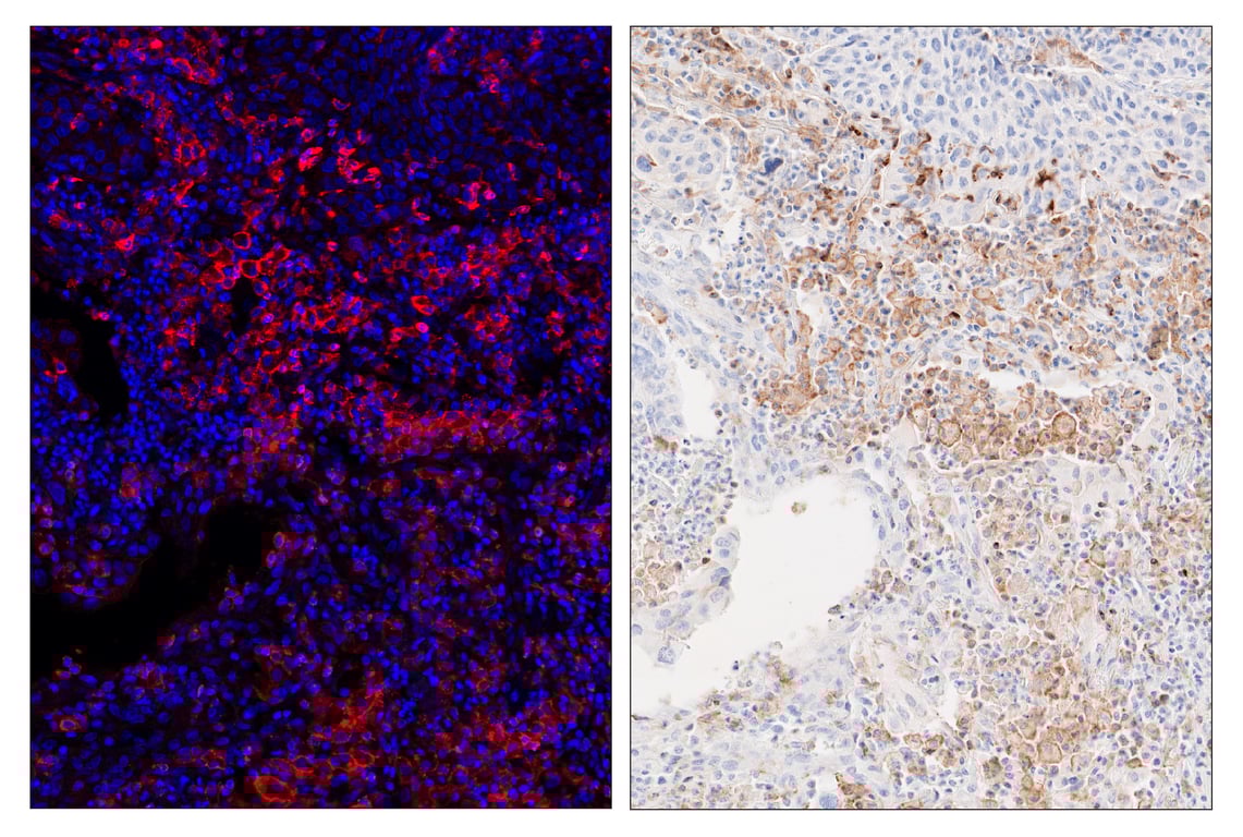 Immunohistochemistry Image 6: TIM-3 (D5D5R) & CO-00010-488 SignalStar<sup>®</sup> Oligo-Antibody Pair