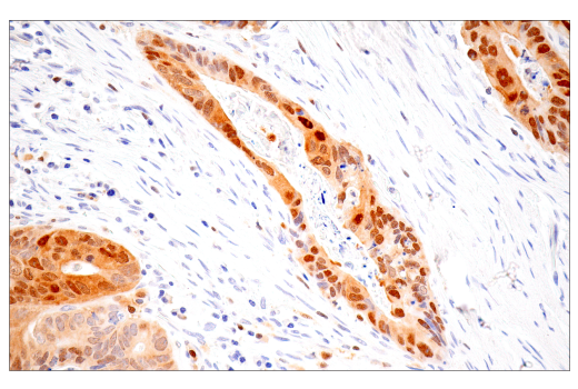 Immunohistochemistry Image 4: IL-18 (E3G8R) Rabbit Monoclonal Antibody (BSA and Azide Free)