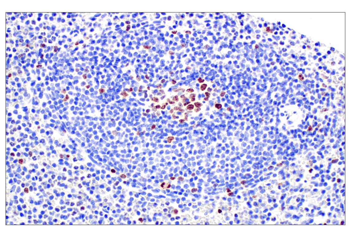 Immunohistochemistry Image 4: Ki-67 (D2H10) Rabbit Monoclonal Antibody