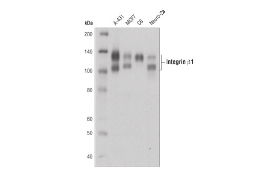 Western Blotting Image 1: Integrin β1 (D6S1W) Rabbit mAb