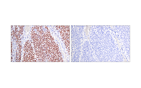 Immunohistochemistry Image 2: Helios (E4L5U) Rabbit Monoclonal Antibody