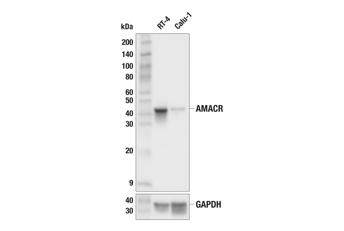 Western Blotting Image 1: AMACR (F7T6V) Rabbit mAb