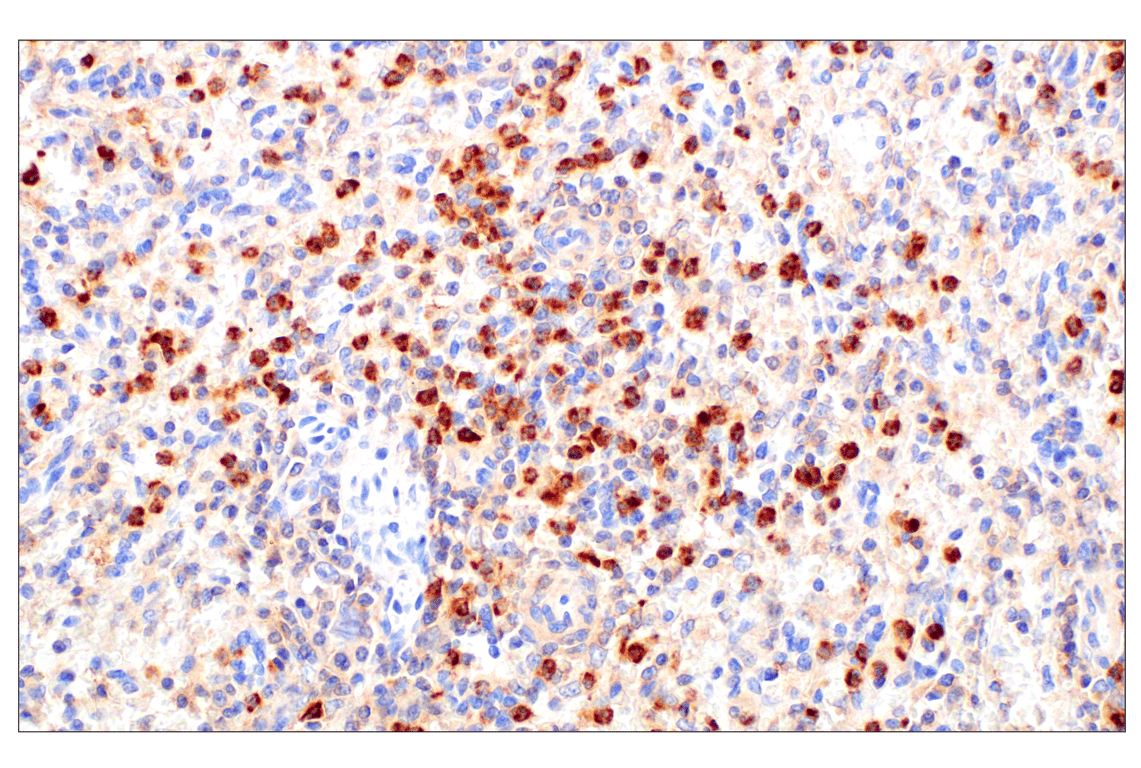 Immunohistochemistry Image 3: RhoA (67B9) Rabbit Monoclonal Antibody