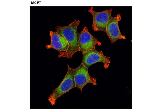 Immunofluorescence Image 1: Rab10 (D36C4) Rabbit Monoclonal Antibody
