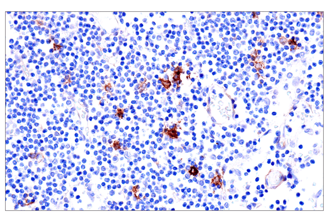 Immunohistochemistry Image 11: p75NTR (E7I3M) Rabbit Monoclonal Antibody (BSA and Azide Free)