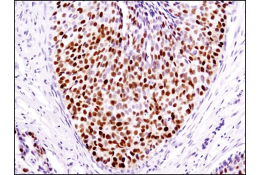 Immunohistochemistry Image 1: Progesterone Receptor A/B (D8Q2J) Rabbit Monoclonal Antibody