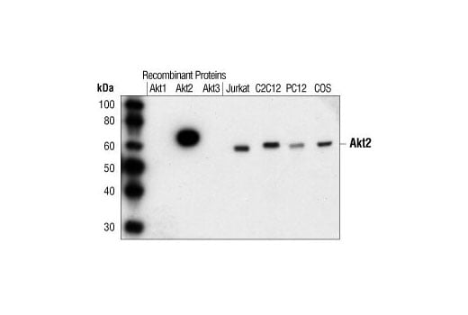 Western Blotting Image 1: Akt2 (5B5) Rabbit mAb