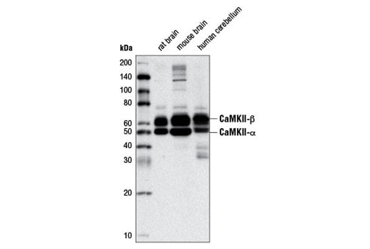 Western Blotting Image 2: Phospho-CaMKII (Thr286) (D21E4) Rabbit mAb