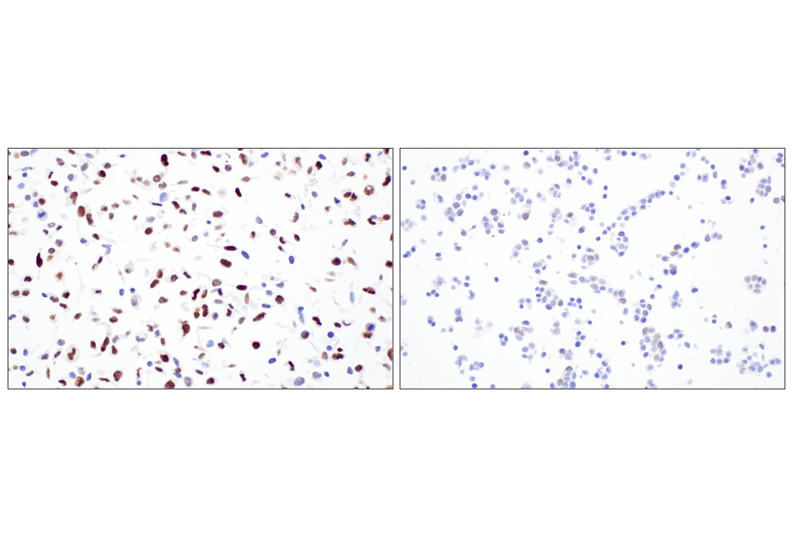 Immunohistochemistry Image 8: MASTL (F7I2C) Rabbit Monoclonal Antibody