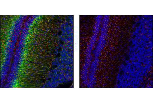 Immunofluorescence Image 1: Phospho-Doublecortin (Ser334) Antibody
