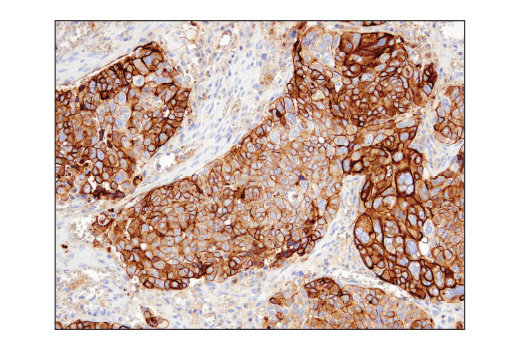 Immunohistochemistry Image 4: CD47 (D3O7P) Rabbit Monoclonal Antibody