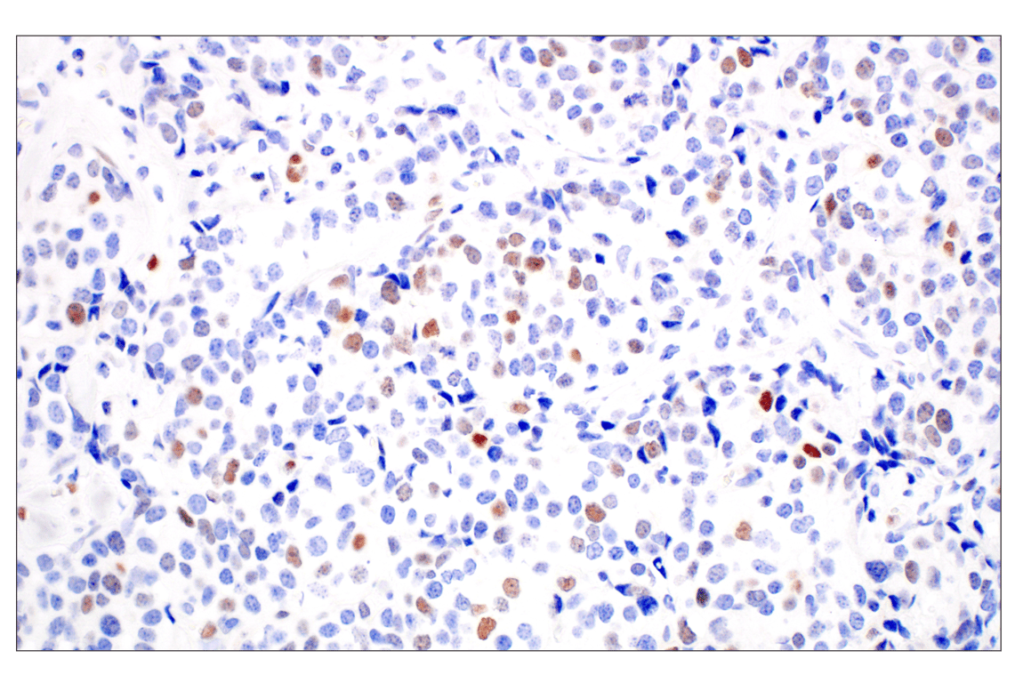 Immunohistochemistry Image 2: KLF2 (E7K8Y) Rabbit Monoclonal Antibody