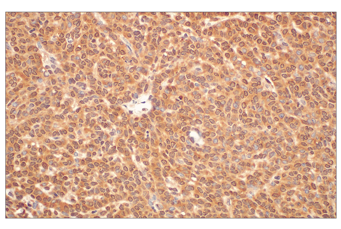 Immunohistochemistry Image 3: MTAP (E5R1I) Rabbit Monoclonal Antibody