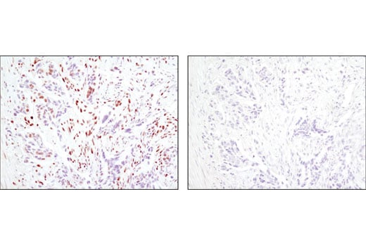 undefined Image 14: Huntingtin Interaction Antibody Sampler Kit