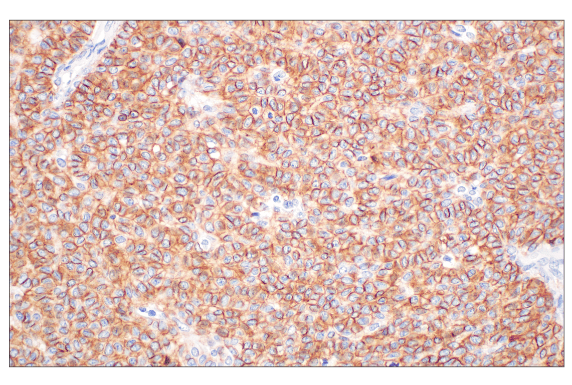 Immunohistochemistry Image 2: MCT1/SLC16A1 (E7A2K) Rabbit Monoclonal Antibody