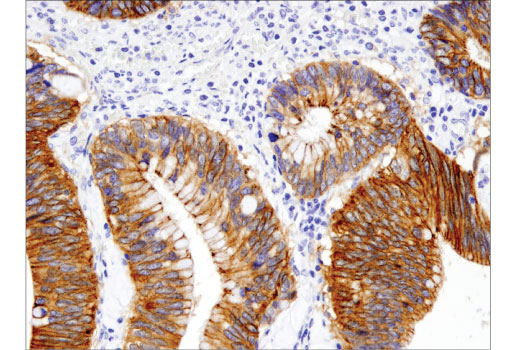 Immunohistochemistry Image 2: γ-Catenin (D9M1Q) Rabbit mAb