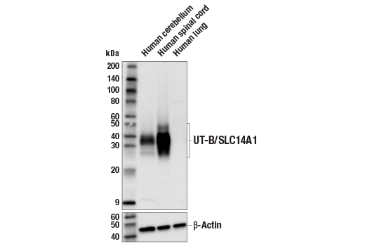 Western Blotting Image 2: UT-B/SLC14A1 (E3S8J) Rabbit Monoclonal Antibody