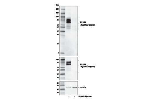 undefined Image 10: IFN-gamma Signaling Pathway Antibody Sampler Kit