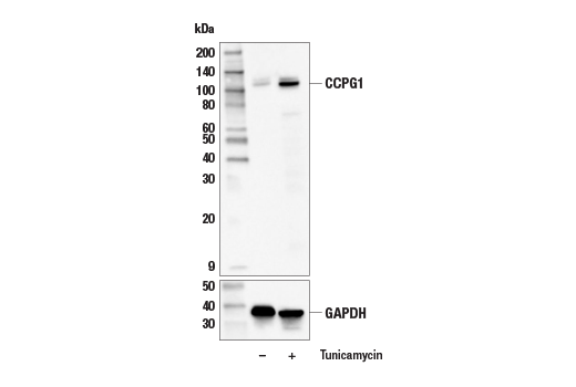 undefined Image 13: ER Homeostasis Antibody Sampler Kit