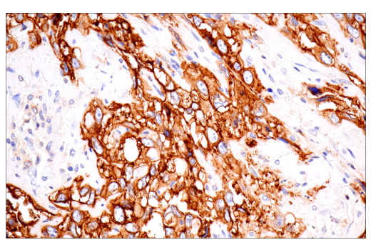 Immunohistochemistry Image 2: CA 19-9 (C241:5:1:4) Mouse Monoclonal Antibody
