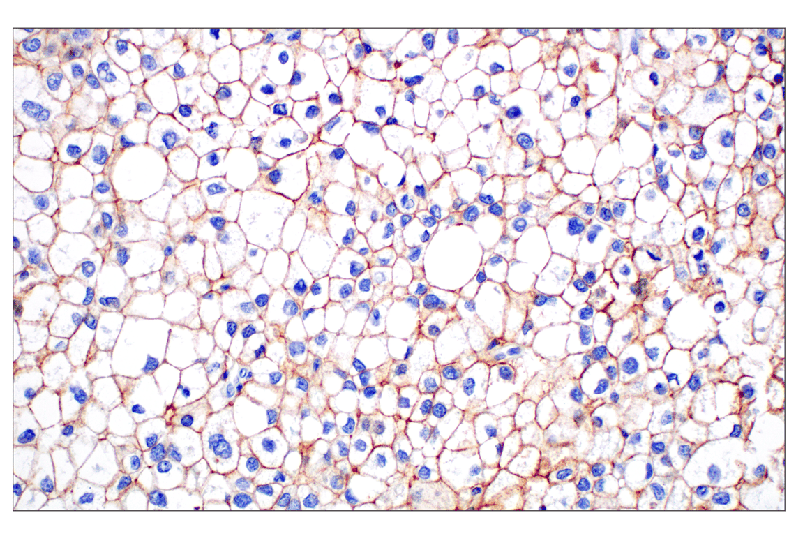 Immunohistochemistry Image 1: SCARB1 (E9H4F) Rabbit Monoclonal Antibody